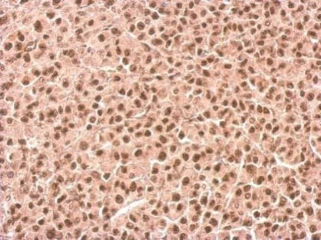 SETD2 Polyclonal Antibody