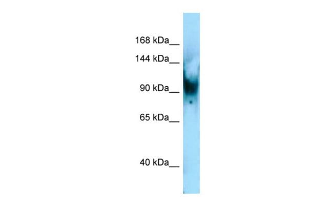 SENP6 Polyclonal Antibody