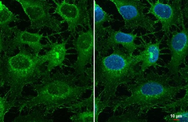 Collagen III Polyclonal Antibody