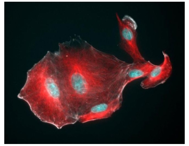 Donkey anti-Mouse IgG (H+L) Highly Cross-Adsorbed Secondary Antibody, Alexa Fluor™ Plus 555