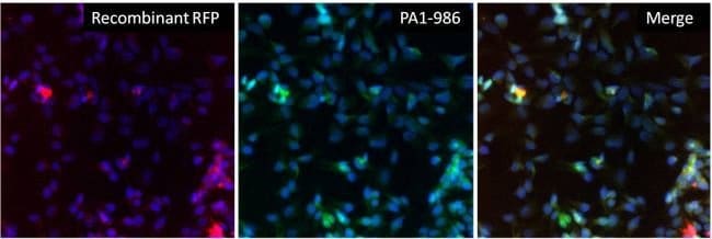 RFP Polyclonal Antibody