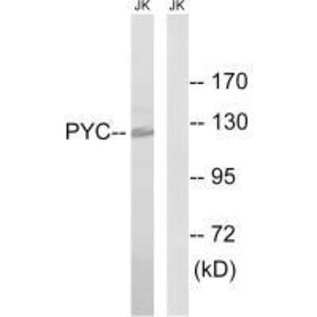 Pyruvate Carboxylase Polyclonal Antibody
